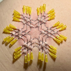 Könnte beinhalten: Nahaufnahme der Haut einer Person mit einem Muster aus gelben Nadeln, die in sie gesteckt sind. Die Nadeln sind in einem symmetrischen Muster angeordnet, das eine Sternform bildet.