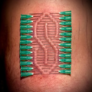 May include: A close-up of a person's skin with a pattern of small, green needles inserted into the skin. The needles are arranged in a symmetrical design.