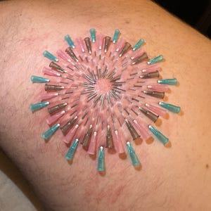 May include: A close-up of a person's leg with a circular pattern of needles inserted into the skin. The needles are arranged in a spiral pattern and are of different colors, including pink, blue, and silver.