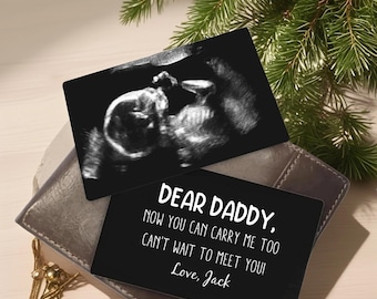 Tarjeta de billetera con foto y ultrasonido de metal personalizada, regalo para ecografía de recién nacido, regalo de embarazo, regalo para papá primerizo, regalo para baby shower, regalo para el Día del Padre