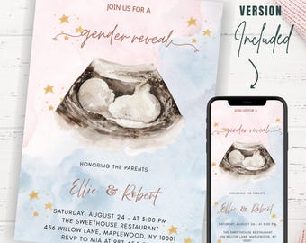 Ultrasound Baby Invitation Editable Template Neutral Watercolor Pregnancy Reveal Phone Version