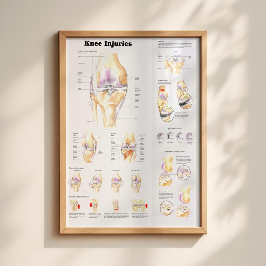 Printmaking Injury Knee Injuries System Wall Chart Poster Print Anatomical Human Body ...