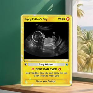 Plaque personnalisée en blocs acryliques, échographie pour la fête des pères, cadeau de grossesse, cadeau nouveau papa pour lui, faire-part de naissance, cadeau pour papa