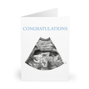 Grußkarten (5er-Pack) Gender Reveal Sonogramm Glückwunschkarte, es ist ein Junge Mama Papa Fine Art Hand gezeichnet, Feiern Babyparty Geschenk