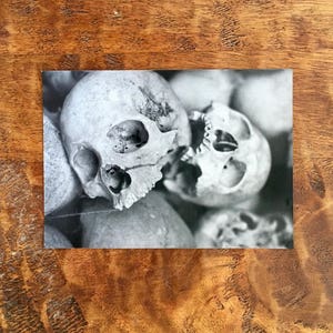 Puede incluir: Una fotografía en blanco y negro de varios cráneos humanos. Los cráneos están dispuestos en una pila, con un cráneo en primer plano.