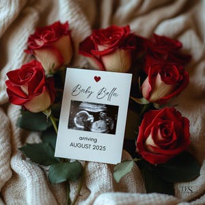 Modelo editável de anúncio de bebê no Canva, cartão de ultrassom com rosas vermelhas, revelação digital elegante de gravidez, download instantâneo, placa de nascimento do bebê