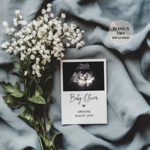 Minimalistische bearbeitbare Babymitteilung mit Ultraschall, digitale Geburt im Vintage-Stil, Canva-Vorlage, druckbare Baby Boy Gender Reveal