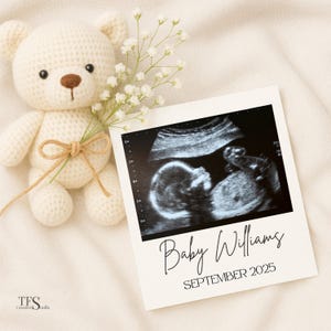 Modèle de faire-part de bébé modifiable, révélation échographique, révélation de bébé Canva, révélation de grossesse numérique, téléchargement immédiat, bébé neutre