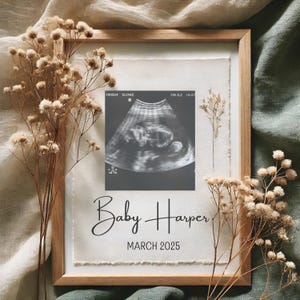 Editable Digital Pregnancy Announcement Template | Gender Neutral Baby Reveal for Social Media | Instant Download Ultrasound Template
