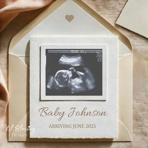 Schwangerschaftsankündigung Digitale Canva Vorlage | Gender Neutral Baby Reveal für Social Media | Bearbeitbare Sofort-Download-Ultraschallvorlage