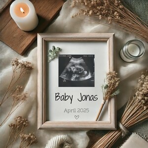 Editable Digital Pregnancy Announcement Template | Gender Neutral Baby Reveal for Social Media | Instant Download Ultrasound Template