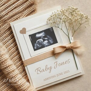 Schwangerschaftsankündigung Digitale Canva Vorlage | Gender Neutral Baby Reveal für Social Media | Bearbeitbare Sofort-Download-Ultraschallvorlage