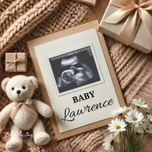 Schwangerschaftsankündigung Digitale Canva Vorlage | Gender Neutral Baby Reveal für Social Media | Bearbeitbare Sofort-Download-Ultraschallvorlage