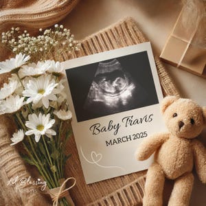 Schwangerschaftsankündigung Digitale Canva Vorlage | Gender Neutral Baby Reveal für Social Media | Bearbeitbare Sofort-Download-Ultraschallvorlage