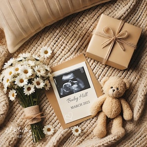 Schwangerschaftsankündigung Digitale Canva Vorlage | Gender Neutral Baby Reveal für Social Media | Bearbeitbare Sofort-Download-Ultraschallvorlage