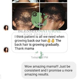 May include: Before and after photos of a child's hair growth. The caption reads "I think patient is all we need when growing back our hair. The back hair is growing gradually. Thank mama."  The text "Today 1:30 PM" is also visible.