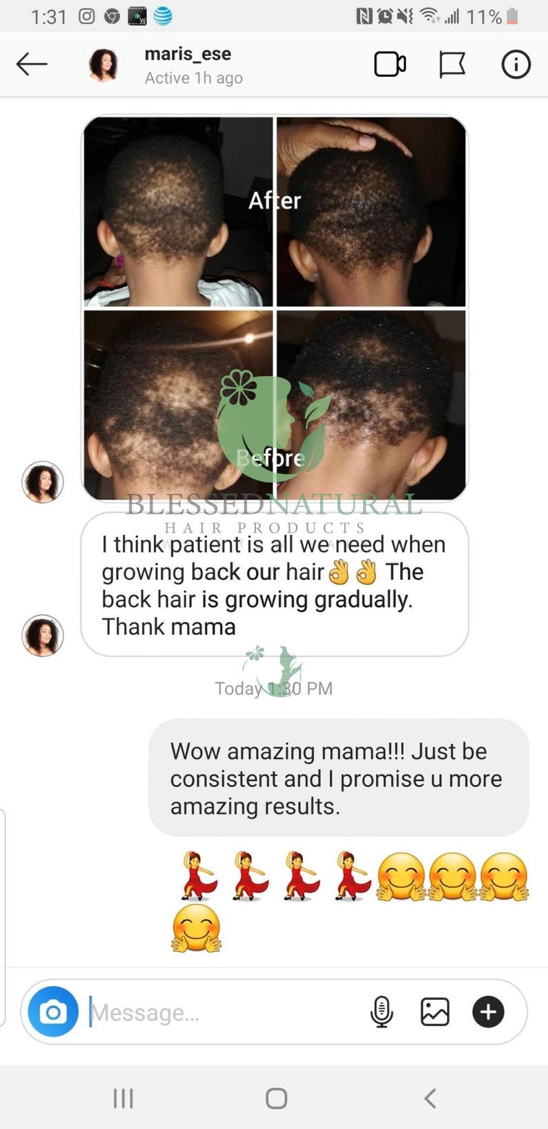 May include: Before and after photos of a child's hair growth. The caption reads "I think patient is all we need when growing back our hair. The back hair is growing gradually. Thank mama."  The text "Today 1:30 PM" is also visible.