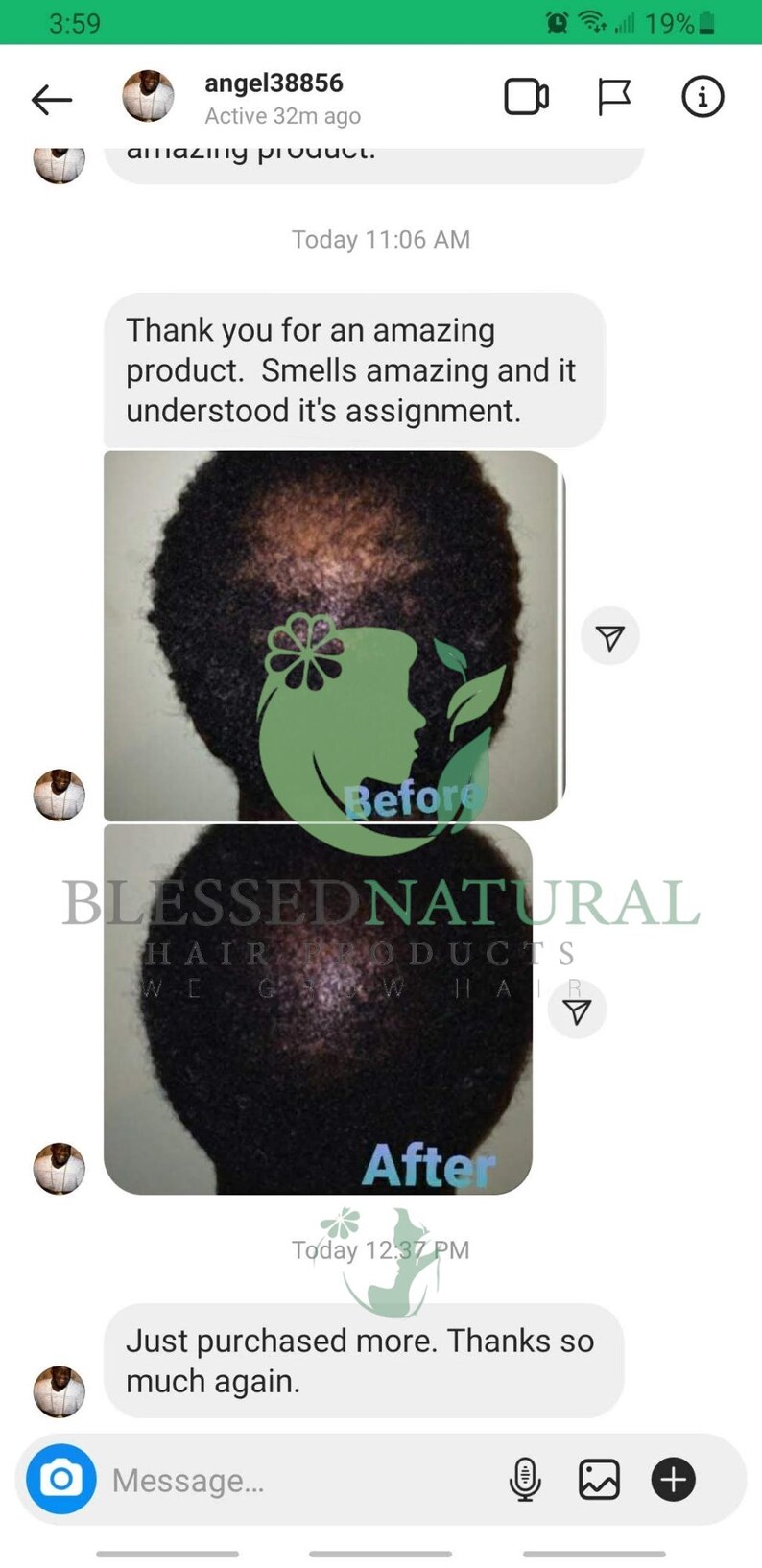 May include: Before and after photos showing the results of a hair growth product. The before photo shows a person with thinning hair on the top of their head. The after photo shows the same person with fuller hair. The product is called "Blessed Natural Hair Products".