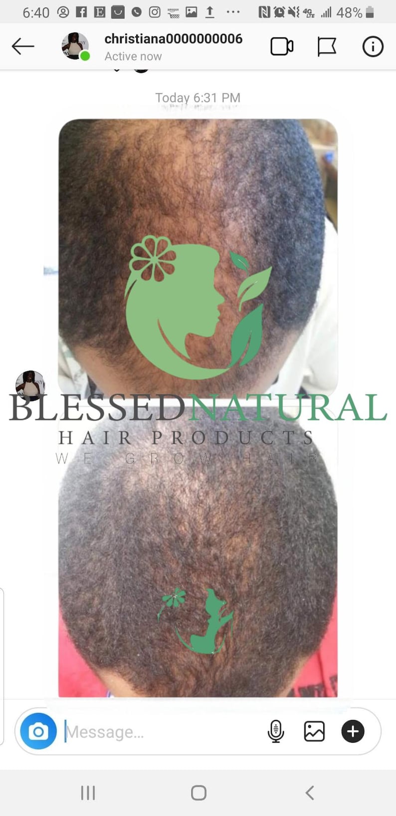 May include: A before and after photo showing hair growth. The top image shows a person's scalp with sparse hair. The bottom image shows the same person's scalp with more hair growth. The image includes the text "BLESSED NATURAL HAIR PRODUCTS WE GROW HAIR".
