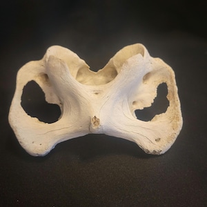 Vertebrae- bone