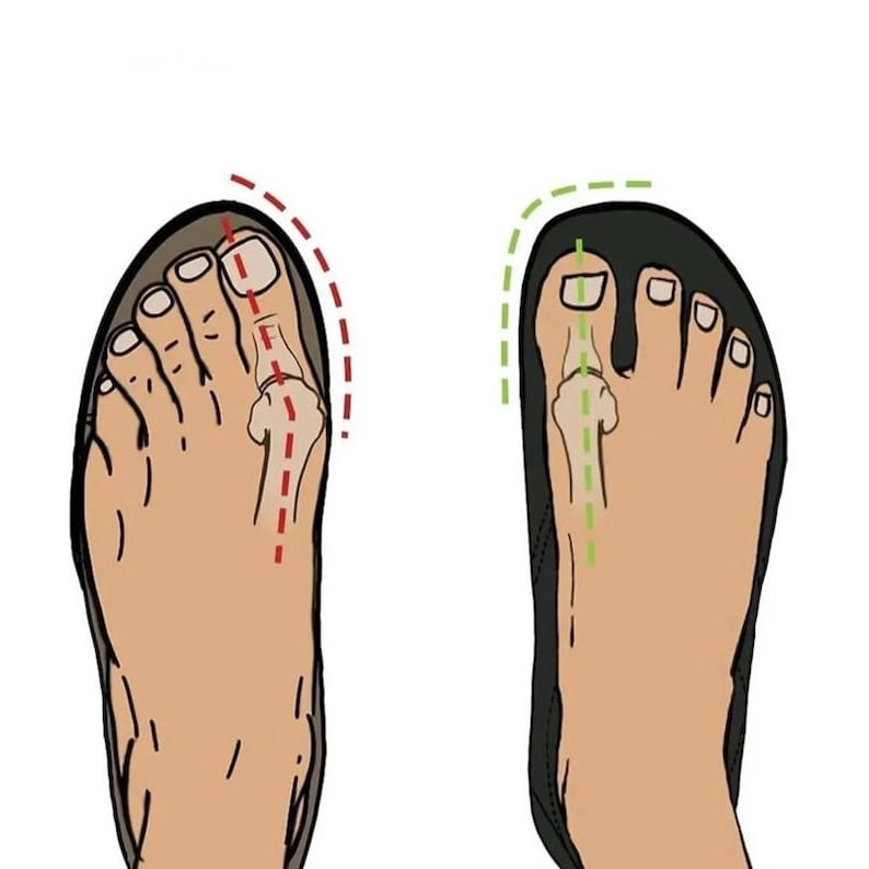 May include: Illustration of two feet, one with a red dashed line showing the proper foot position in a shoe, and the other with a green dashed line showing the improper foot position in a shoe.