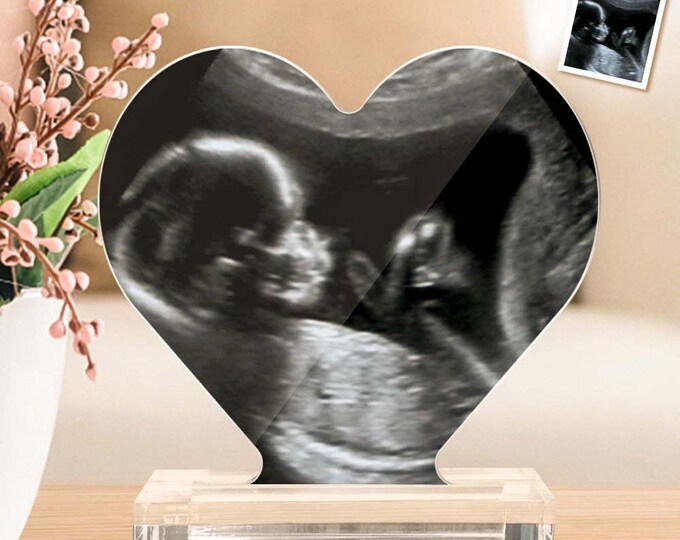 Ultrasound Photo Heart Shaped Acrylic Plaque – Custom Baby Gift for Expectant Mother, Personalized Keepsake, Pregnancy Announcement Decor