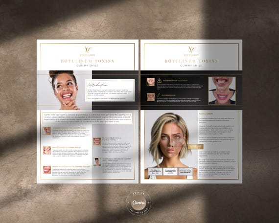 Botox Lesson Gummy Smile Cheat Sheets, Reference Guide, Learning Resource or Printable Poster for Botulinum Toxins Aesthetics Practitioners