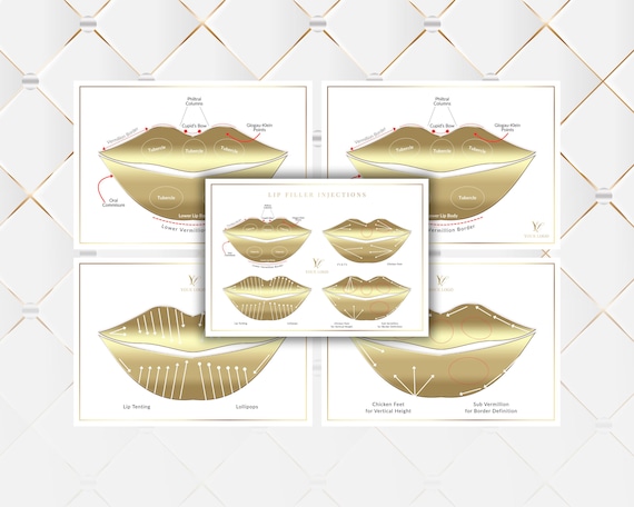 Lip Filler Injection Techniques Practice Templates (Digital Download)