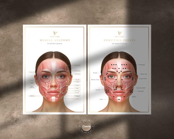 Botox Injection Points and Labelled Muscles of the Face, Canva Editable A4 Study, Reference Guides or Wall Art for Botulinum Toxin Injectors
