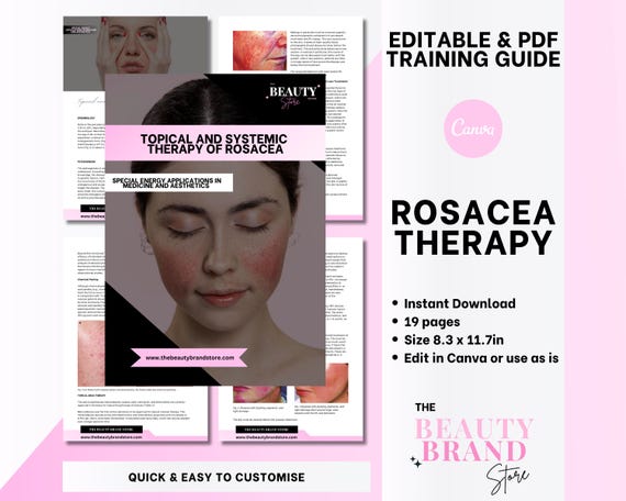 Part 10 Rosacea Training Guide, Topical and Systemic Therapy of Rosacea, Training Manual Resources, Editable Template + PDF eBook