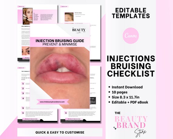 Aesthetics Injections Bruising Guide & Checklist, Cosmetic Aesthetics, Medspa, Educator, Student, Clinic, Office, Nurse, Editable PDF E-Book