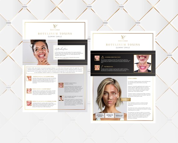 Botox Lesson Gummy Smile Cheat Sheets, Reference Guide, Learning Resource or Printable Poster for Botulinum Toxins Aesthetics Practitioners