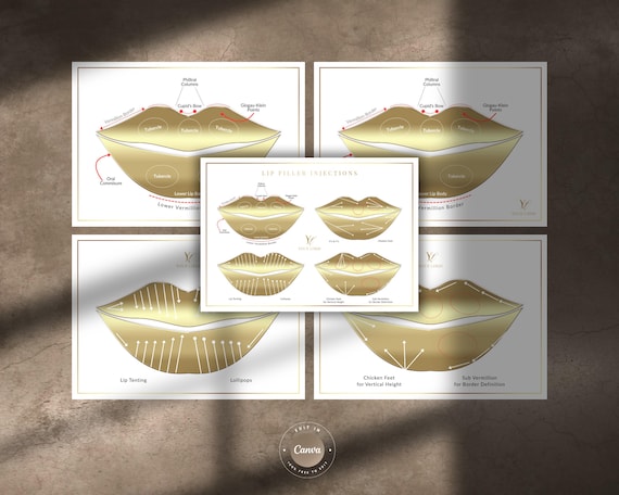 Lip Filler Injection Techniques Editable Practice Templates: Aesthetics Tutor Student Resource (PDF, JPG, PNG)