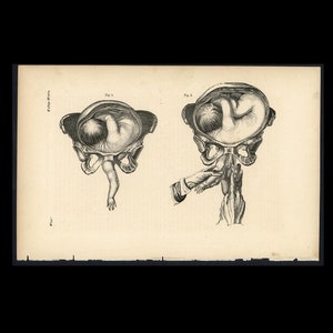 c. 1860 BABY IN WOMB lithograph • original antique print • fetus anatomy • pregnant mother • in utero • birthing print • Mother&#39;s Day gift