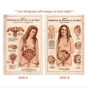c. 1929 EMBRYO DEVELOPMENT lithograph • original antique print • fetus print • pregnant woman • baby in womb • prenatal • OBGYN • two sided!
