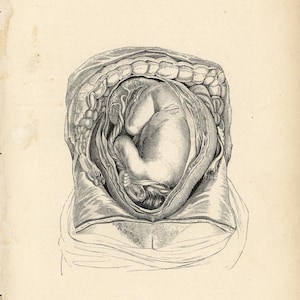 c. 1860 BABY IN WOMB lithograph • original antique print • fetus anatomy • pregnant mother • in utero • birthing print • Mother&#39;s Day gift