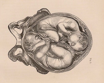 絵画 the memory in the womb Drawings of an Embryo in the Uterus, c1480