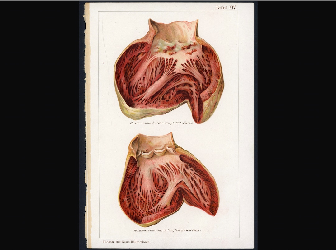 C. 1902 HUMAN HEART ANATOMY Lithograph • Original Antique Print ...