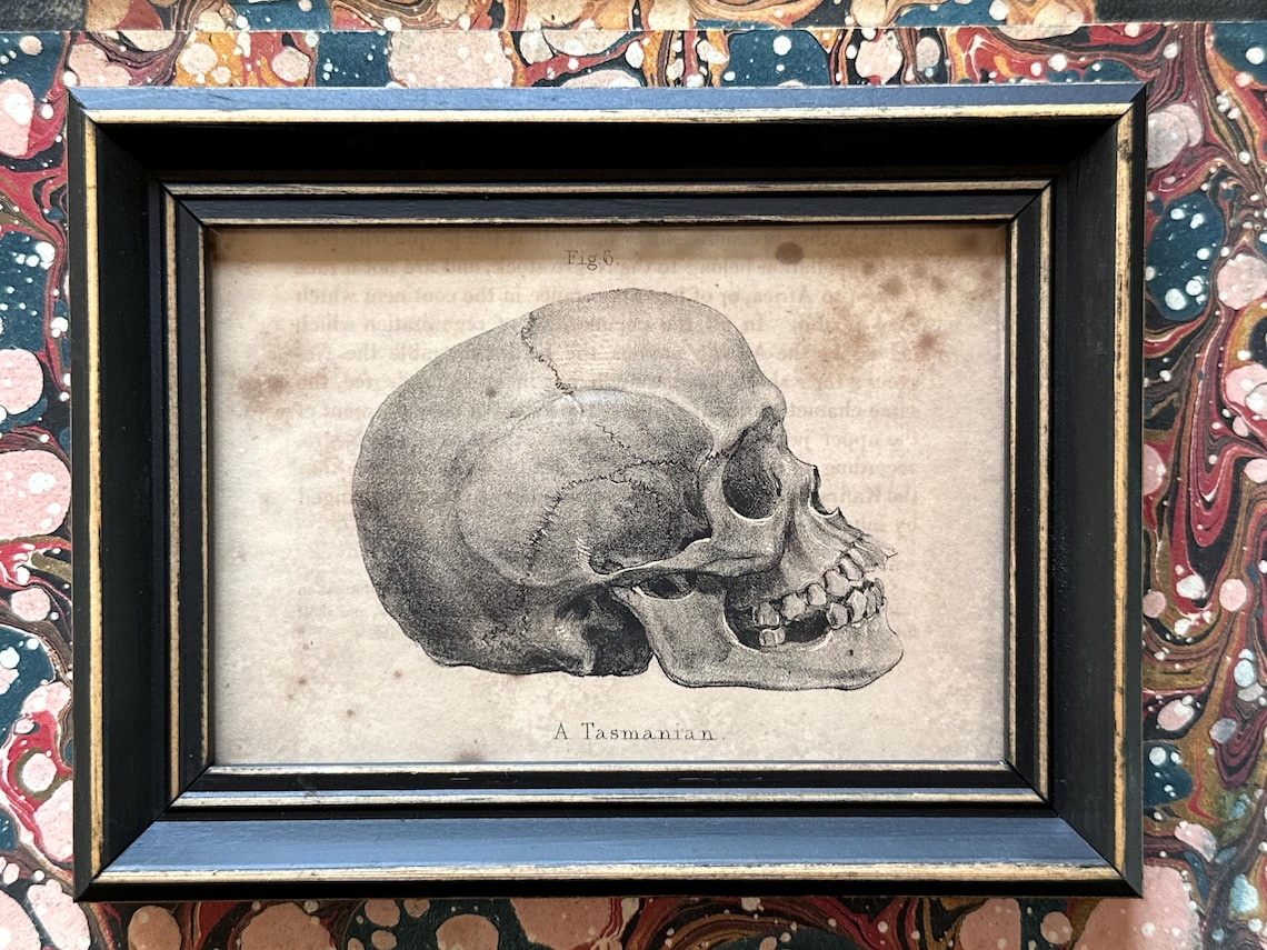 C. 1837 FRAMED SKULL Lithograph • Original Antique Print • Human ...