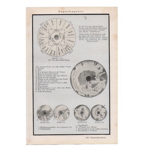 c. 1926 EYE ANATOMY PRINT - original antique medical print - human anatomy print - eye disease print - Optometrist - Ophthalmologist