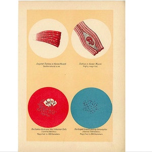 c. 1906 BACTERIA DISEASES PRINT - antique medical lithograph - infectious bacterium - cholera malaria tuberculosis diphtheria tetanus staph