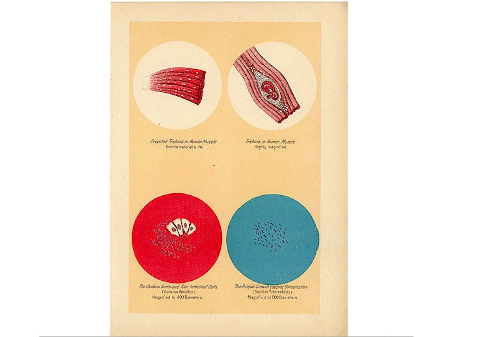 c. 1906 BACTERIA DISEASES PRINT - antique medical lithograph - infectious bacterium - cholera malaria tuberculosis diphtheria tetanus staph