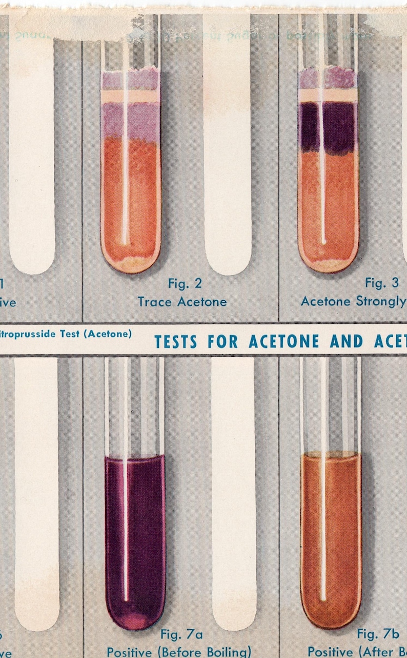 C 1940 TEST TUBE CHARTS Print • Set of 2 Original Vintage Prints ...