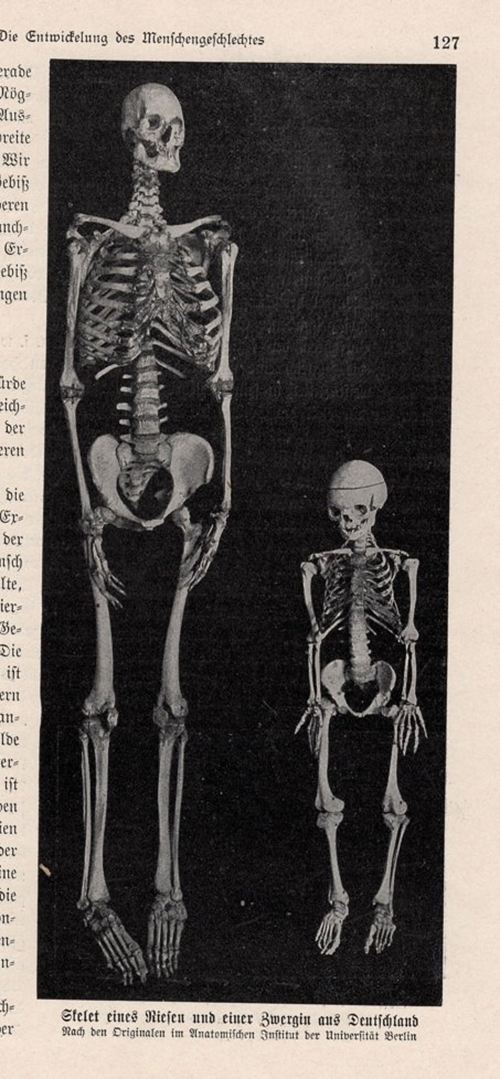 HUMAN SKELETONS Print C. 1900 • Original Antique Print • Antique ...