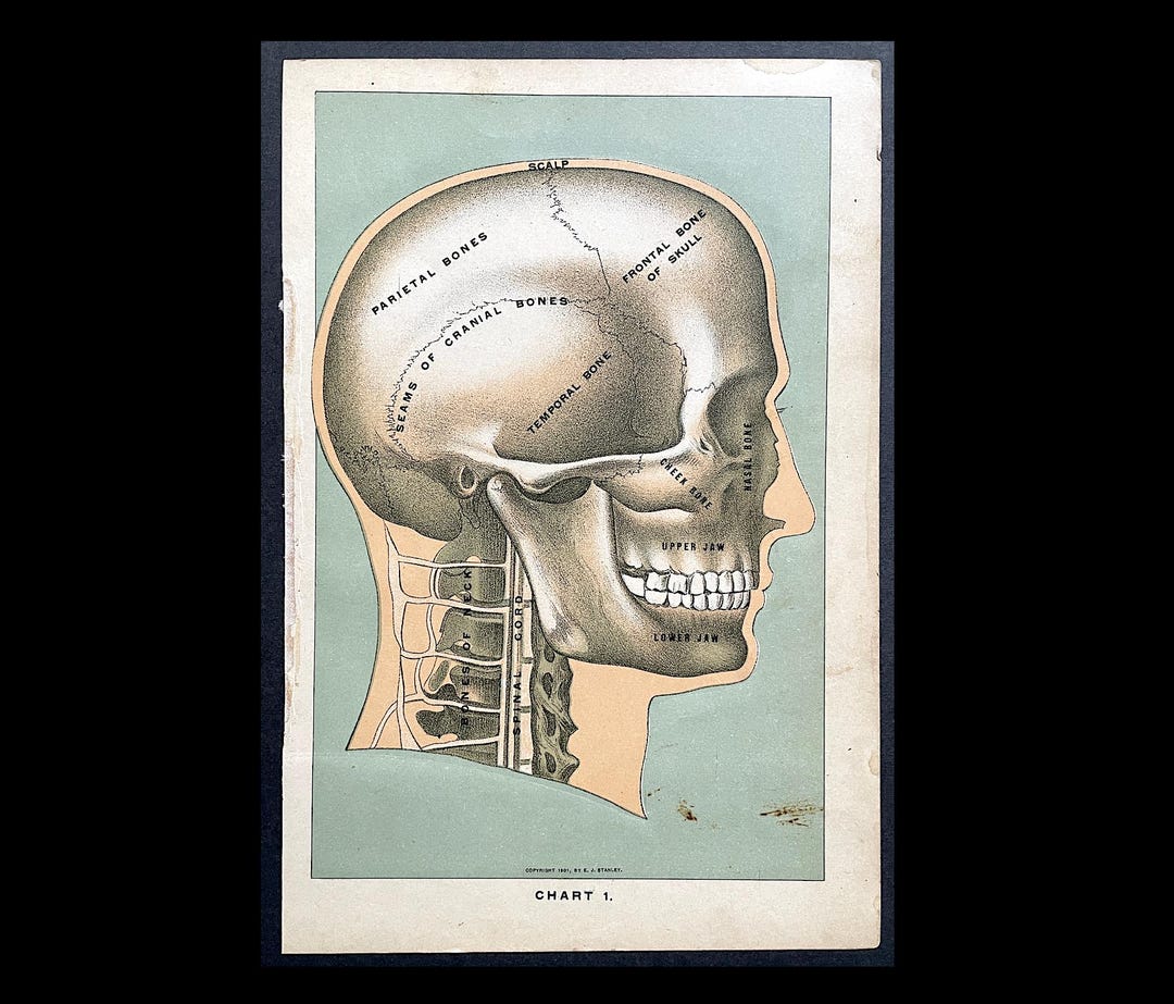 C. 1901 SKULL Lithograph • Original Antique Print • Halloween Decor ...