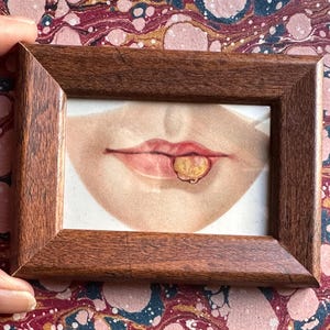 May include: A framed illustration of a mouth with a large, yellow, fleshy growth on the lower lip.
