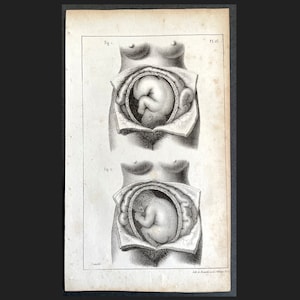 c. 1835 IN UTERO lithograph • original antique print • female anatomy • Mother&#39;s Day • pregnant mother • childbirth print • baby in womb