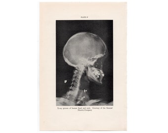 c. 1934 X-RAY HEAD & NECK lithograph • original vintage print • human anatomy print • photo litho from the Smithsonian Museum Inventions