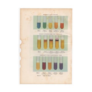 c 1951 URINE TEST TABELS afdrukken • originele vintage print • urine-analyse • medische illustratie • Benedict's & Gerhardt's tests • suikertest