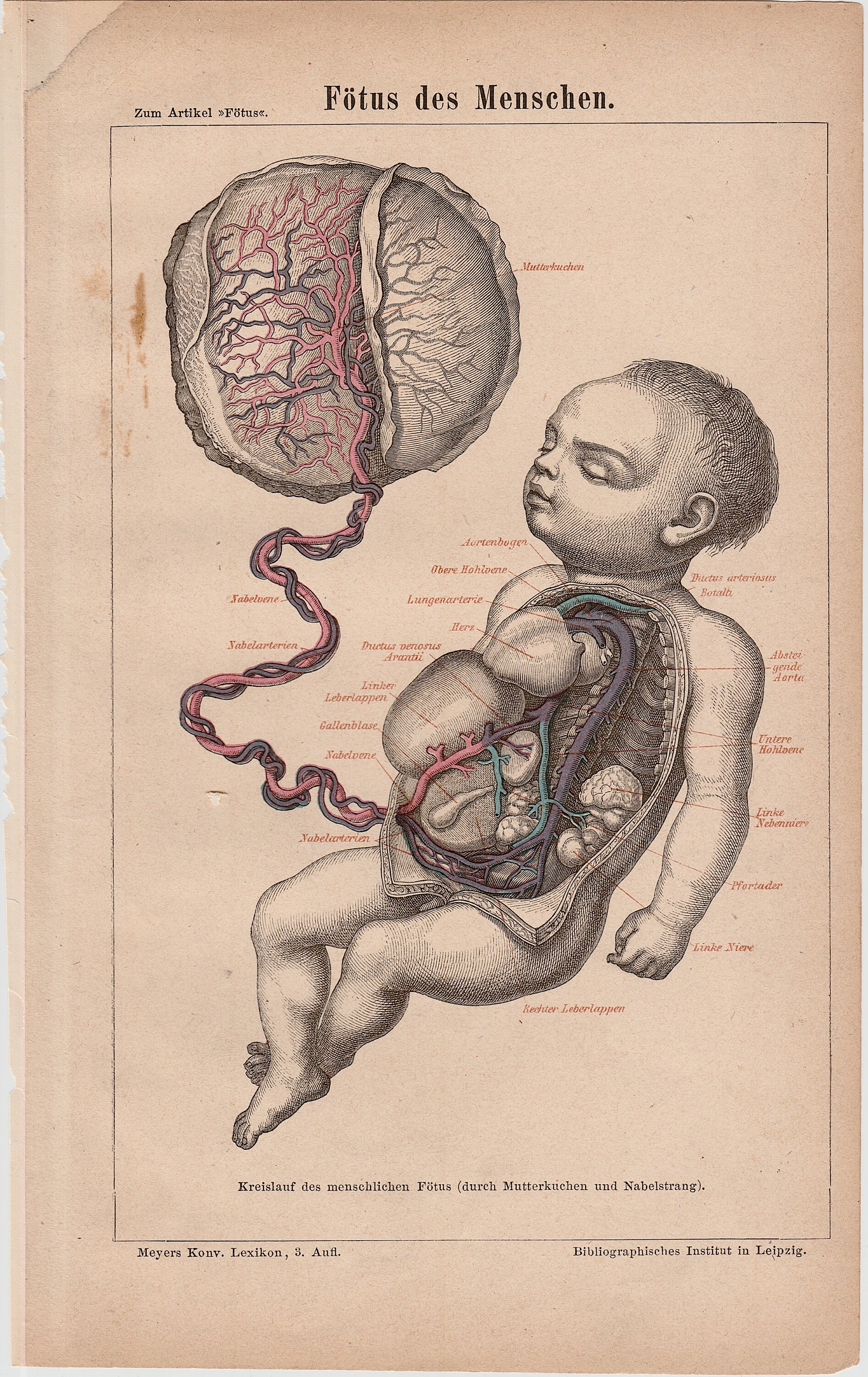 C. 1875 FETUS BABY ANATOMY Lithograph • Original Antique